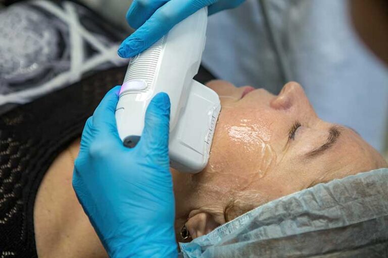 Revolutionary Ulthera New Era in Facial Lifting